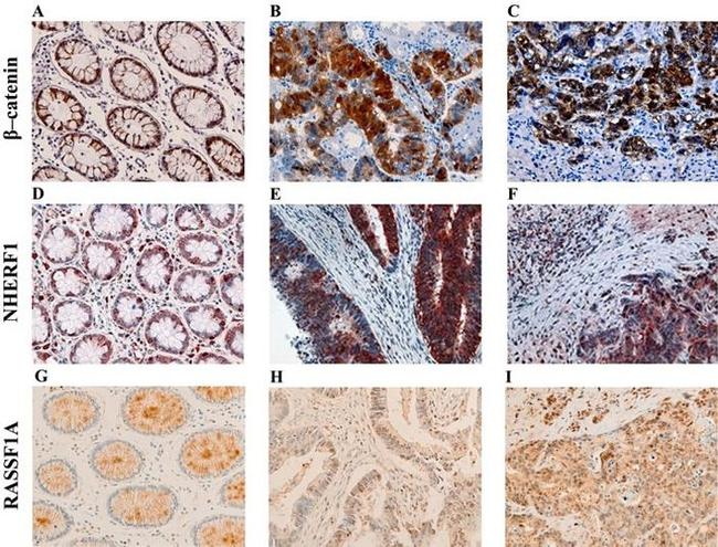 EBP50 Antibody in Immunohistochemistry (Paraffin) (IHC (P))