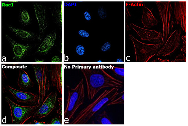 RAC1 Antibody in Immunocytochemistry (ICC/IF)