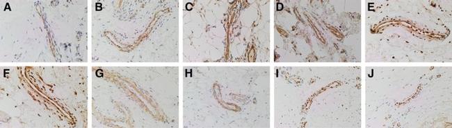 SOX2 Antibody in Immunohistochemistry (Paraffin) (IHC (P))