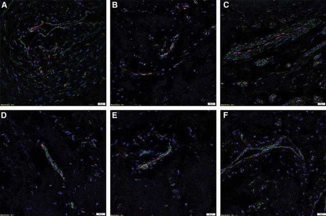 SOX2 Antibody in Immunohistochemistry (Paraffin) (IHC (P))