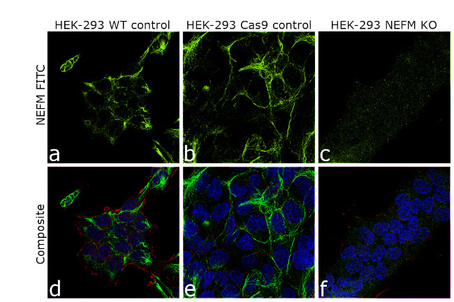 NEFM Antibody in Immunocytochemistry (ICC/IF)