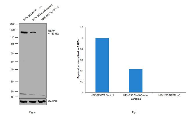 NEFM Antibody in Western Blot (WB)