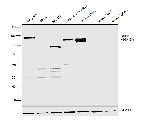 NEFM Antibody