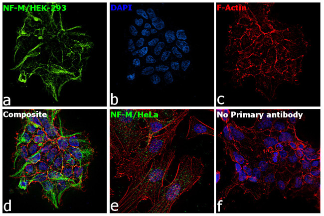 NEFM Antibody in Immunocytochemistry (ICC/IF)