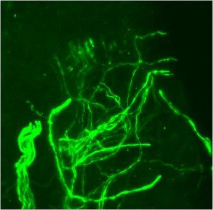 NF-H Antibody in Immunohistochemistry (Frozen) (IHC (F))