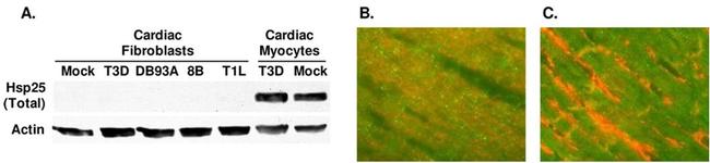 Vimentin Antibody in Immunocytochemistry (ICC/IF)