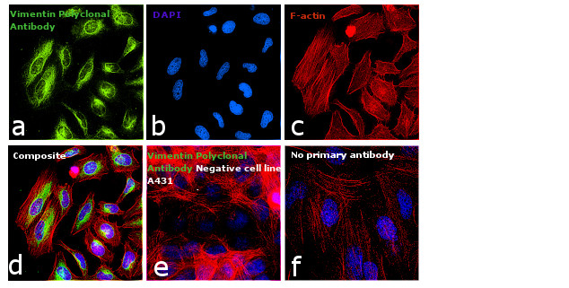 Vimentin Antibody in Immunocytochemistry (ICC/IF)