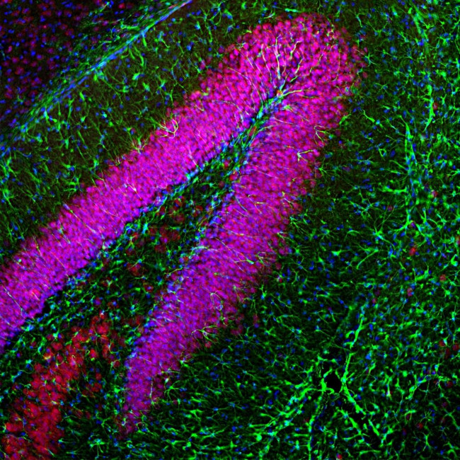 GFAP Antibody in Immunohistochemistry (Paraffin) (IHC (P))