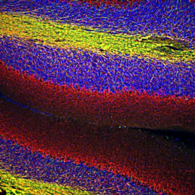 MBP Antibody in Immunocytochemistry (ICC/IF)