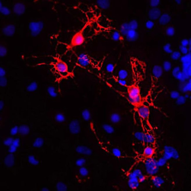 MBP Antibody in Immunocytochemistry (ICC/IF)