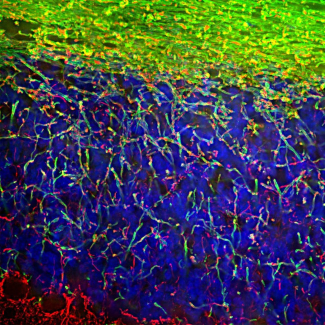 MBP Antibody in Immunocytochemistry (ICC/IF)