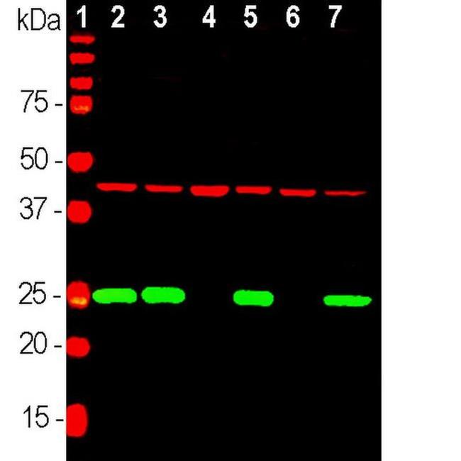 PGP9.5 Antibody in Western Blot (WB)