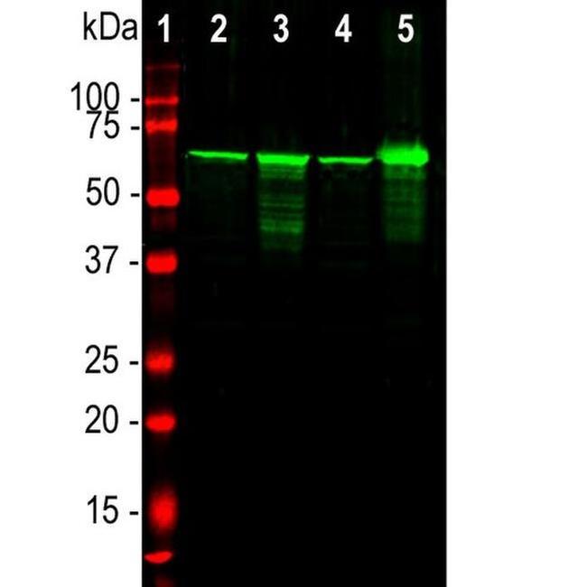 NEFL Antibody in Western Blot (WB)