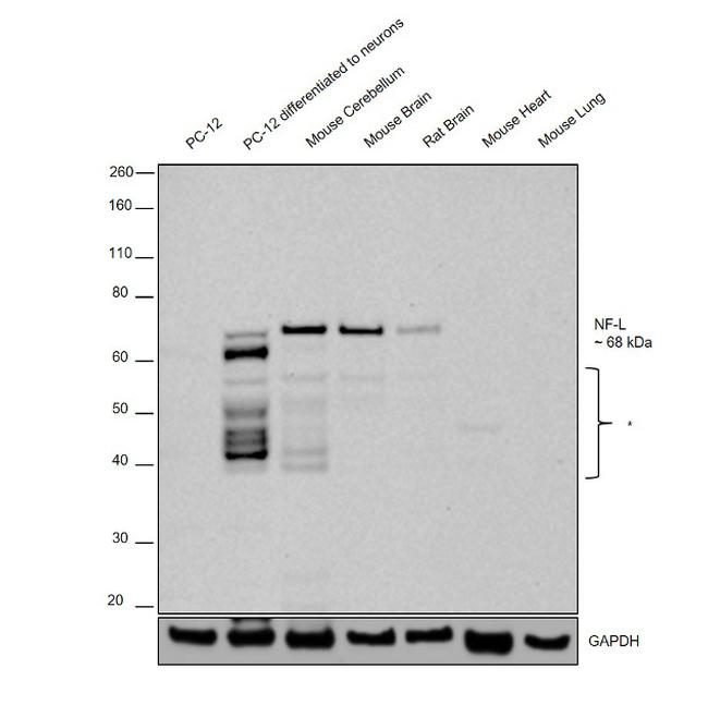 NEFL Antibody in Western Blot (WB)