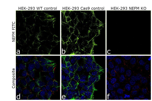 NEFM Antibody in Immunocytochemistry (ICC/IF)