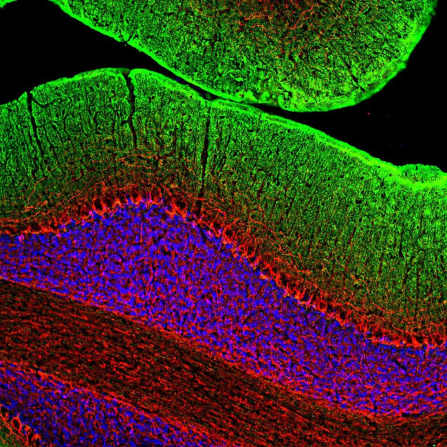 NEFM Antibody in Immunohistochemistry (Paraffin) (IHC (P))