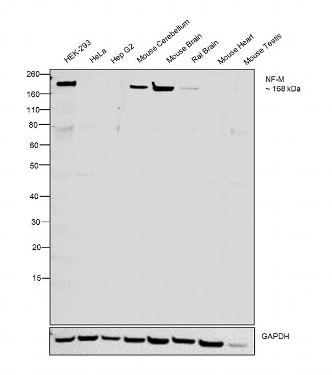 NEFM Antibody in Western Blot (WB)