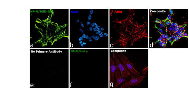 NEFM Antibody in Immunocytochemistry (ICC/IF)