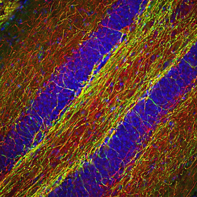 NF-H Antibody in Immunohistochemistry (Paraffin) (IHC (P))