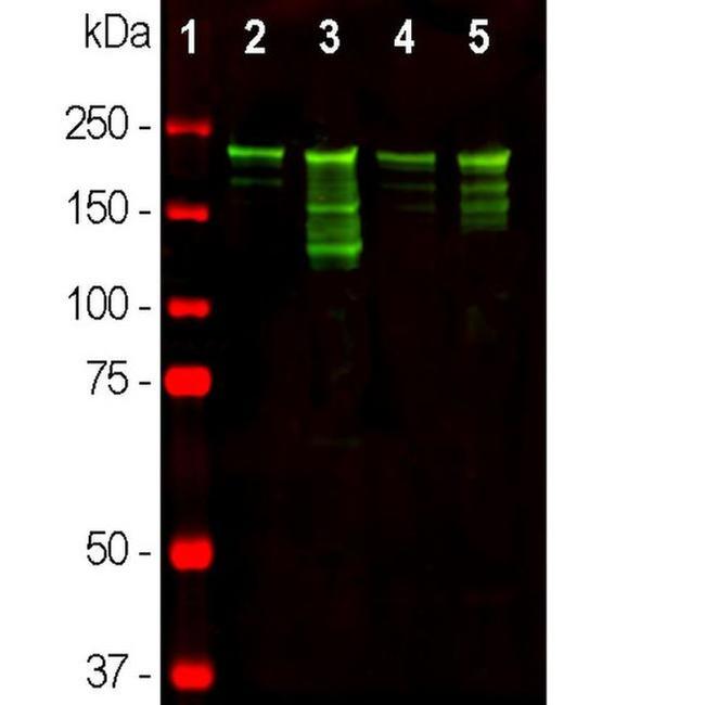 NF-H Antibody in Western Blot (WB)