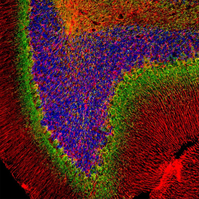 alpha Internexin Antibody in Immunocytochemistry (ICC/IF)