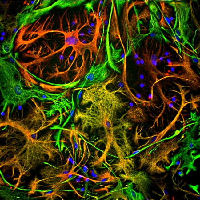 GFAP Antibody in Immunocytochemistry (ICC/IF)