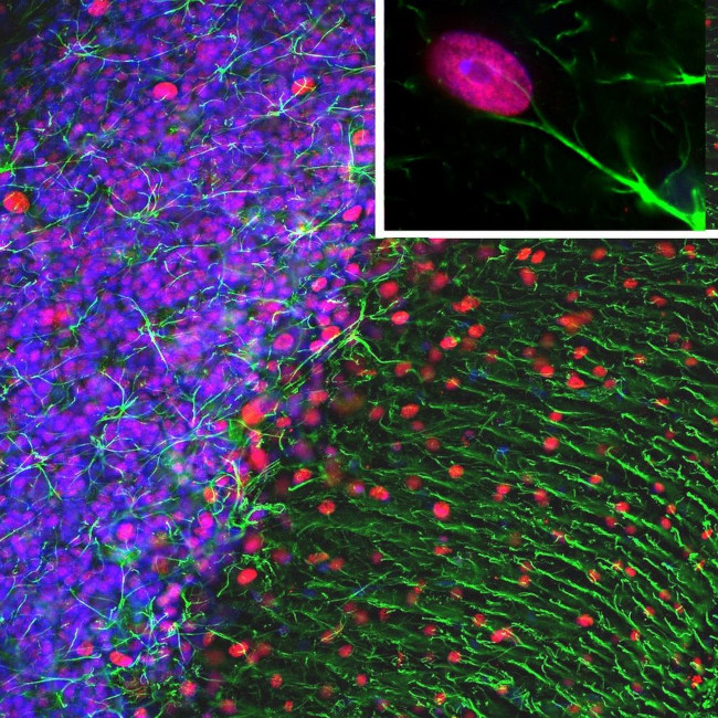 GFAP Antibody in Immunocytochemistry (ICC/IF)