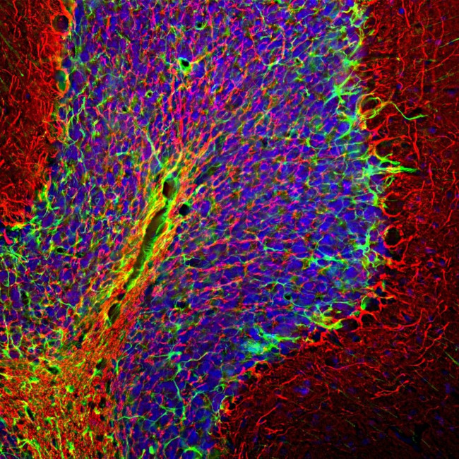 GFAP Antibody in Immunohistochemistry (Paraffin) (IHC (P))