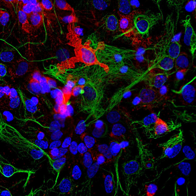 Coronin 1A Antibody in Immunocytochemistry (ICC/IF)