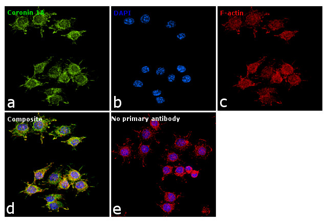 Coronin 1A Antibody in Immunocytochemistry (ICC/IF)