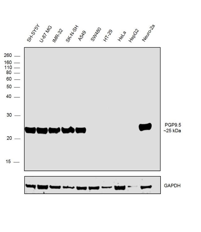 PGP9.5 Antibody in Western Blot (WB)