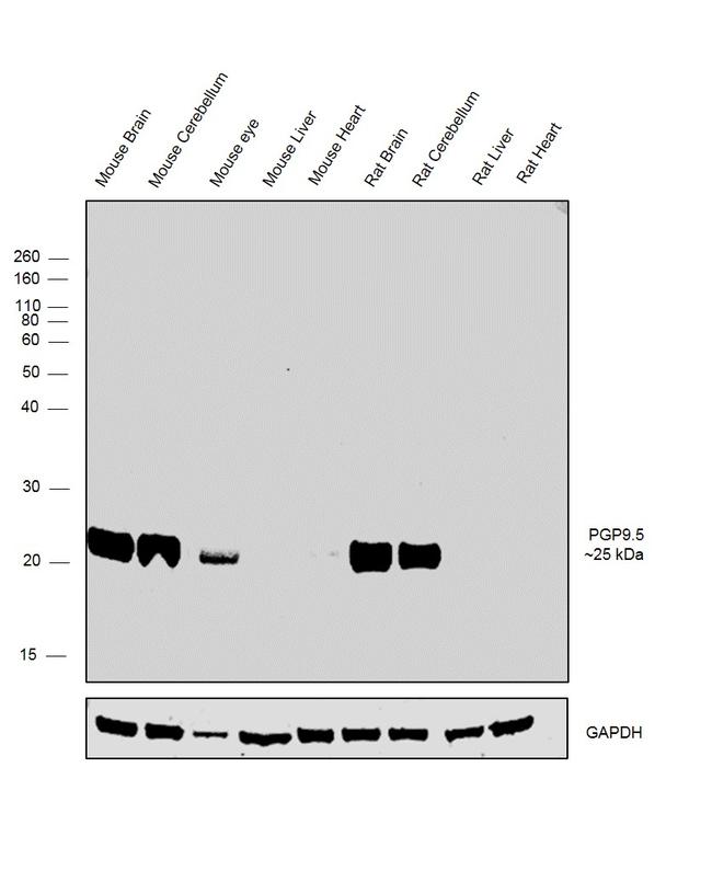 PGP9.5 Antibody in Western Blot (WB)