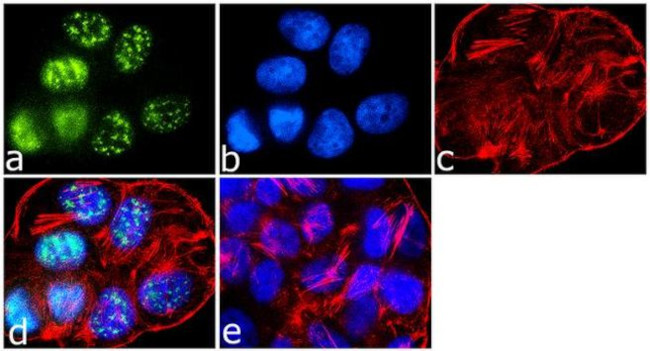 IRS1 Antibody in Immunocytochemistry (ICC/IF)