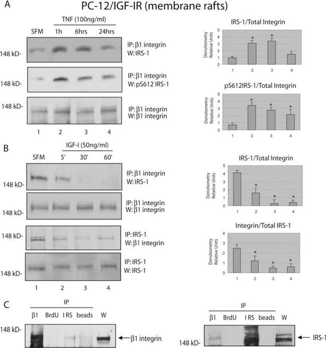 IRS1 Antibody in Western Blot (WB)