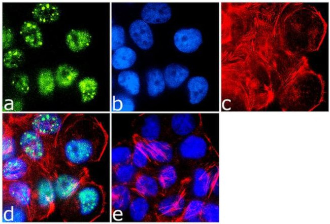 IRS1 Antibody in Immunocytochemistry (ICC/IF)