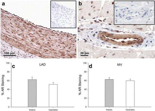 Androgen Receptor Antibody in Immunohistochemistry (IHC)