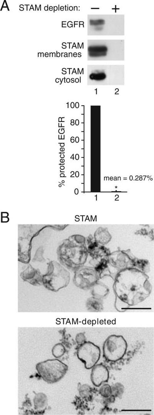 EGFR Antibody in Western Blot (WB)