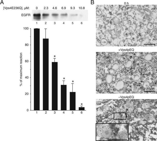 EGFR Antibody in Western Blot (WB)