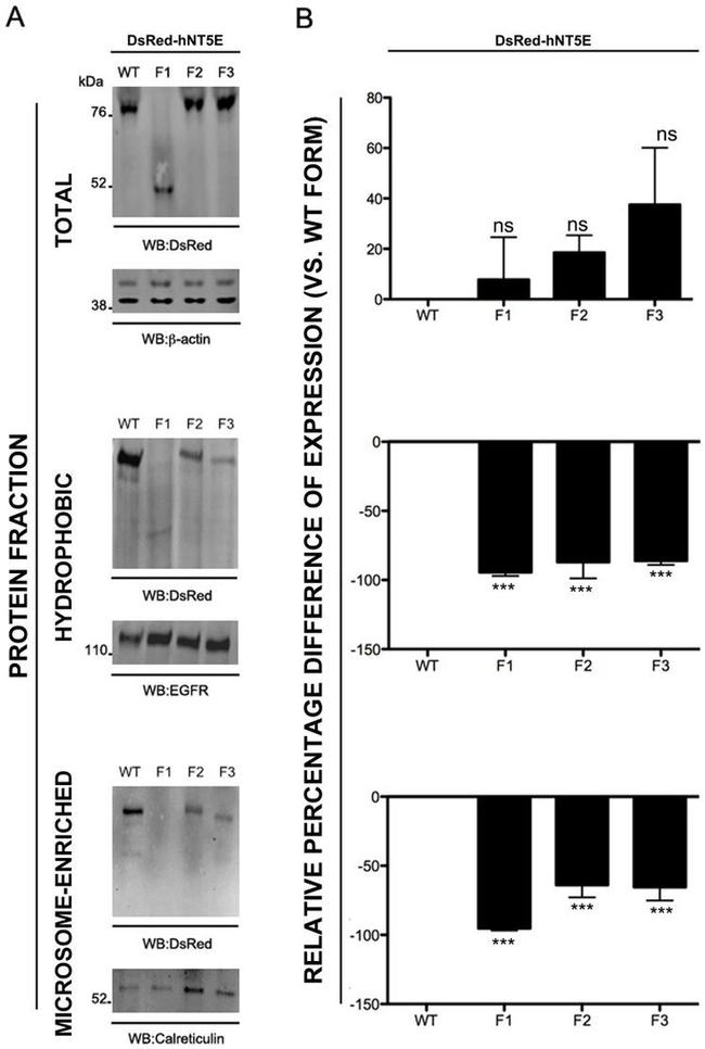 EGFR Antibody in Western Blot (WB)