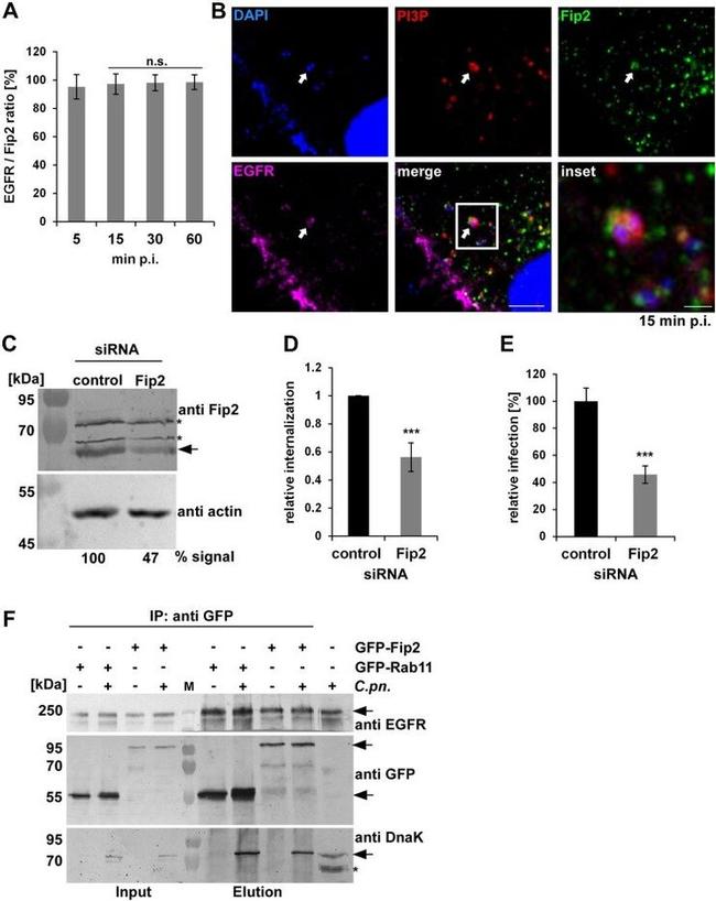 EGFR Antibody in Western Blot, Immunocytochemistry (WB, ICC/IF)