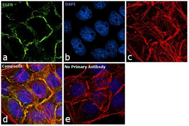 EGFR Antibody in Immunocytochemistry (ICC/IF)