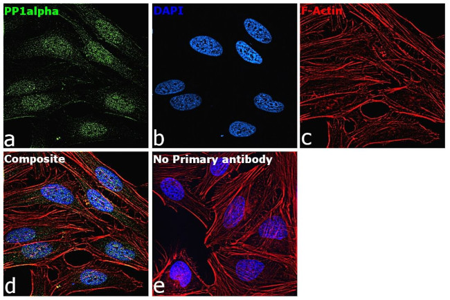 PP1 alpha Antibody in Immunocytochemistry (ICC/IF)