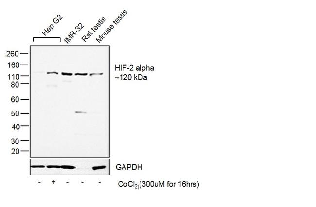 HIF-2 alpha Antibody in Western Blot (WB)