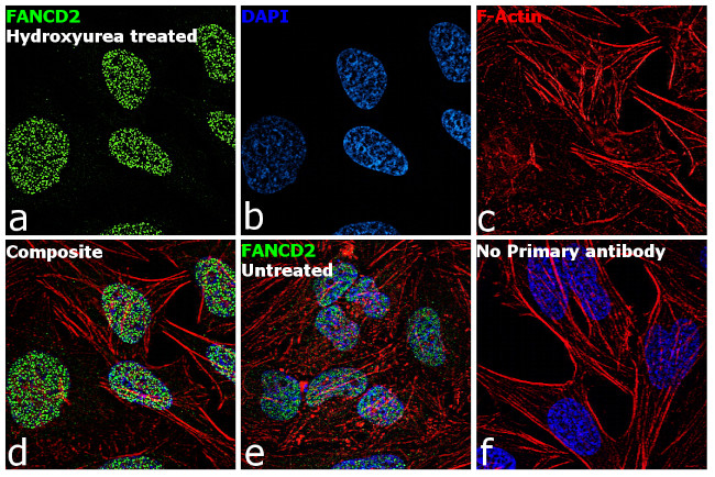 FANCD2 Antibody in Immunocytochemistry (ICC/IF)