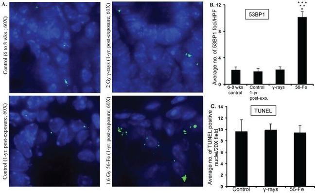 53BP1 Antibody in Immunohistochemistry (Paraffin) (IHC (P))