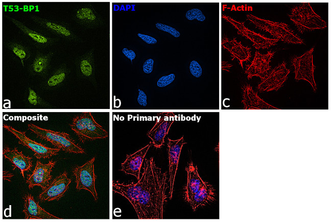 53BP1 Antibody in Immunocytochemistry (ICC/IF)