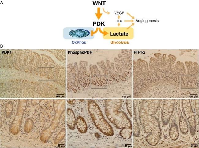 HIF1A Antibody in Immunohistochemistry (IHC)