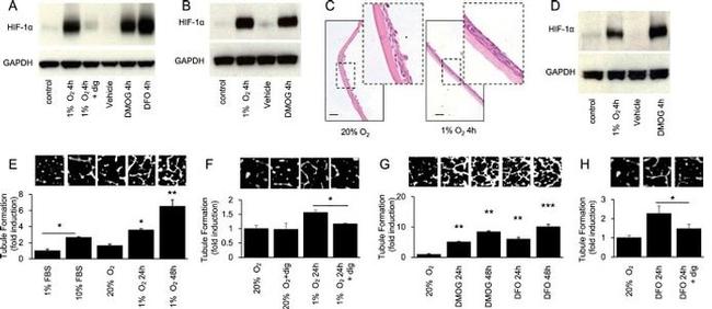 HIF1A Antibody in Western Blot (WB)