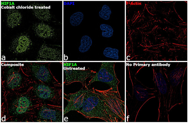 HIF1A Antibody in Immunocytochemistry (ICC/IF)