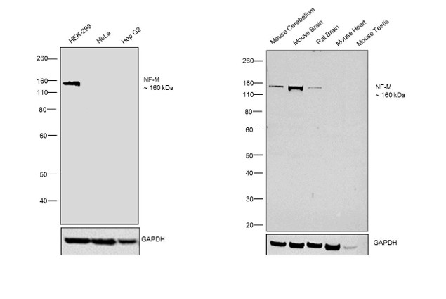 NEFM Antibody